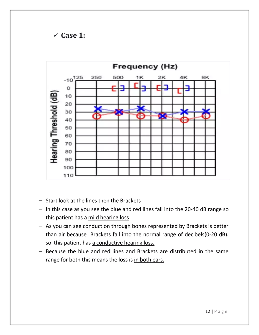 The Auditory System - Page 4