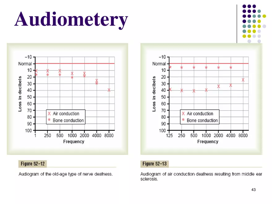 Auditory Sensation (Hearing) - Page 38