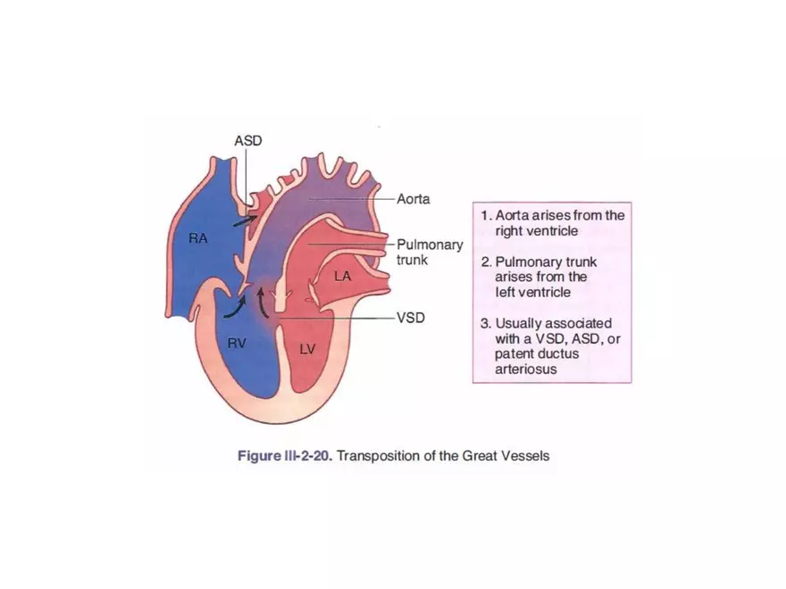 Truncus Arteriosus and Bulbus Cordis - Page 9