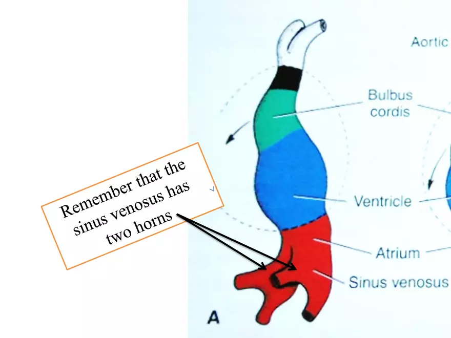 Truncus Arteriosus and Bulbus Cordis - Page 11