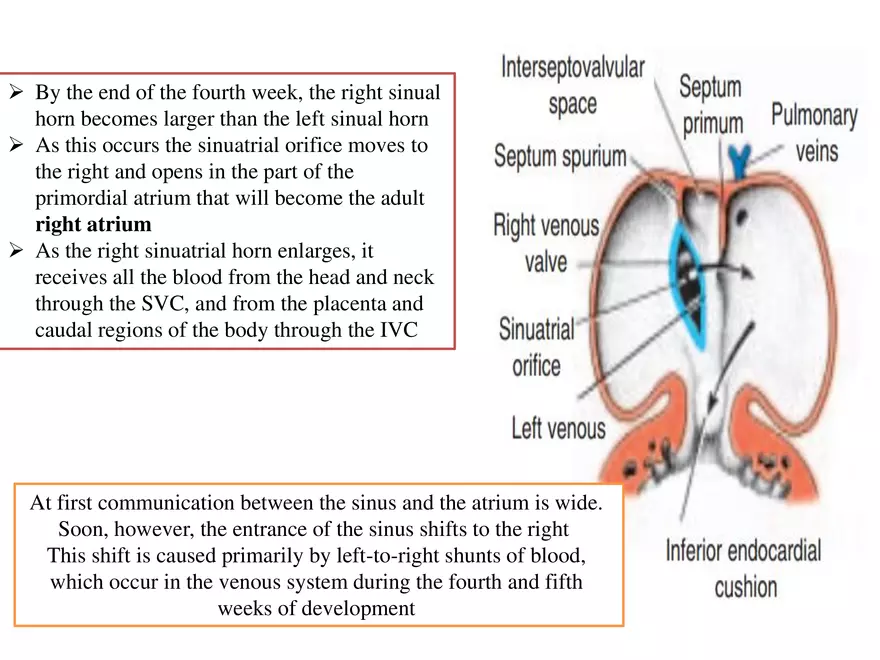 Truncus Arteriosus and Bulbus Cordis - Page 17
