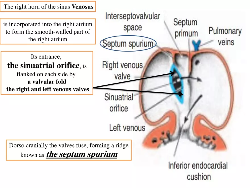 Truncus Arteriosus and Bulbus Cordis - Page 18