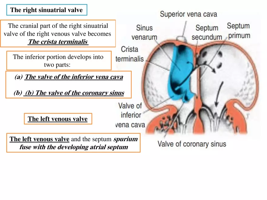 Truncus Arteriosus and Bulbus Cordis - Page 19