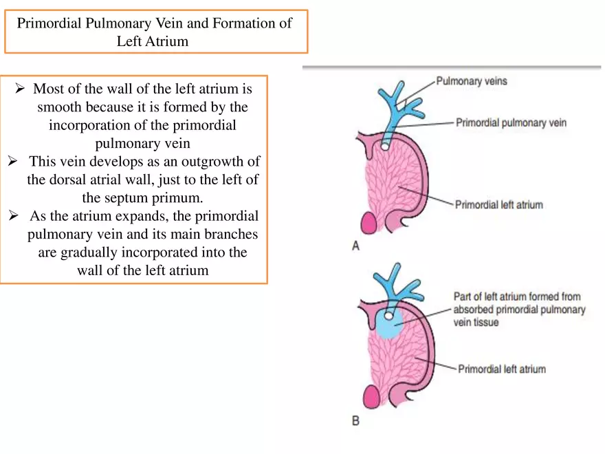 Truncus Arteriosus and Bulbus Cordis - Page 21