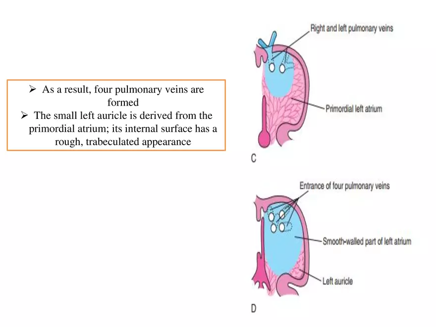 Truncus Arteriosus and Bulbus Cordis - Page 22