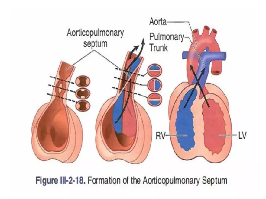 Truncus Arteriosus and Bulbus Cordis - Page 25