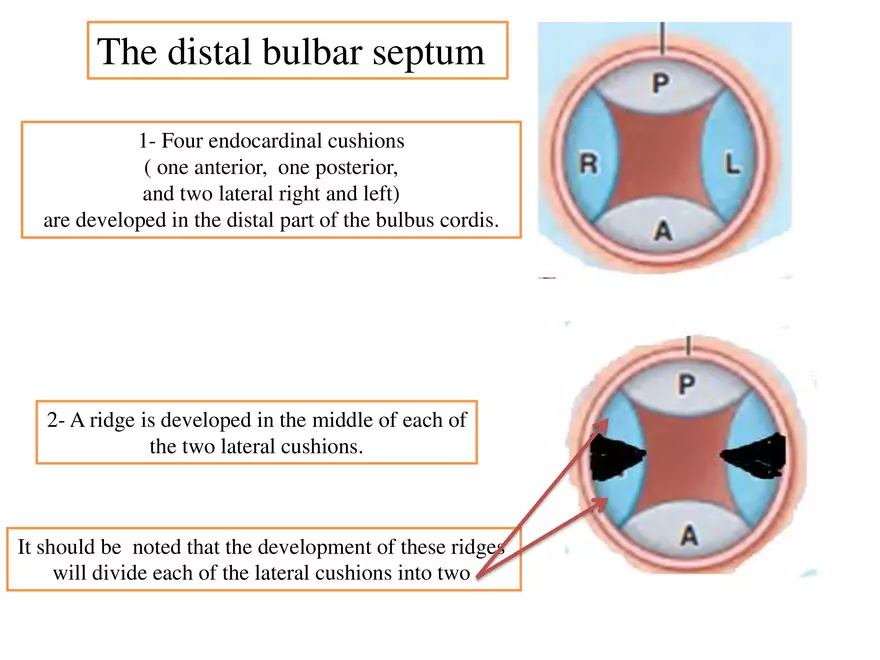 Truncus Arteriosus and Bulbus Cordis - Page 27