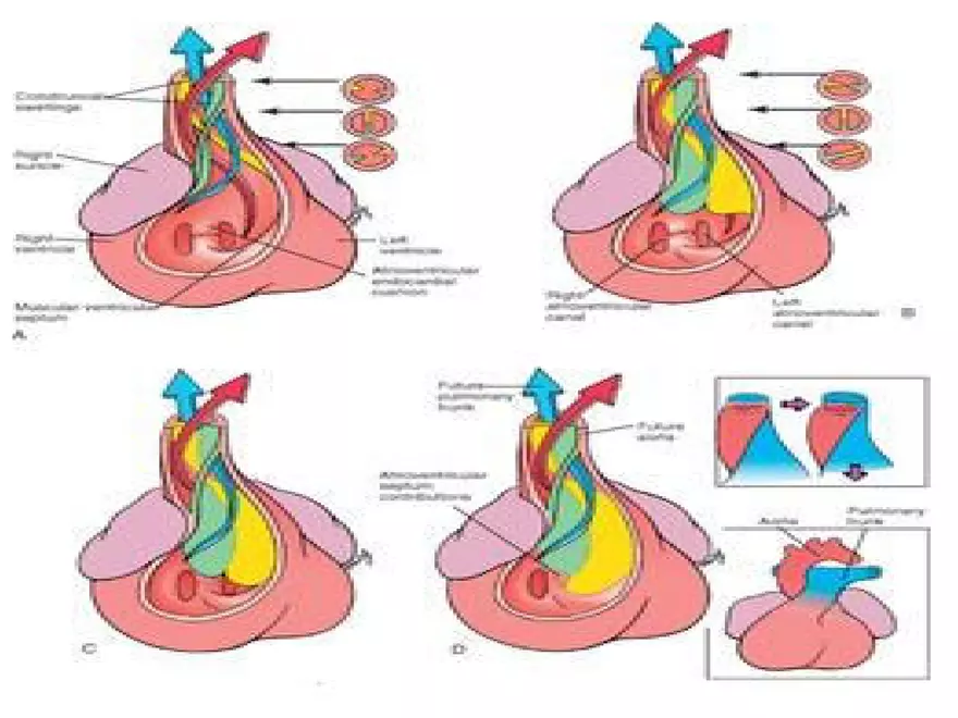 Truncus Arteriosus and Bulbus Cordis - Page 6