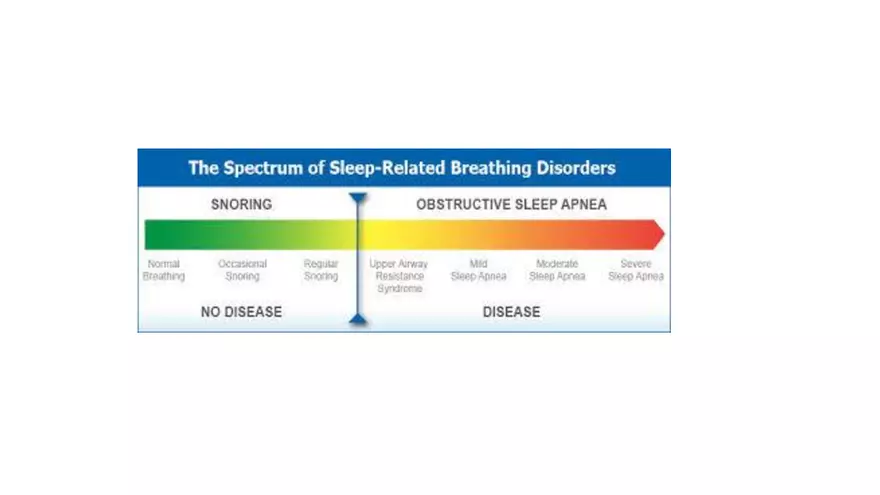 Obstructive Sleep Apnea Obesity Hypoventilation Syndrome - Page 46