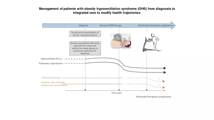 Obstructive Sleep Apnea Obesity Hypoventilation Syndrome - Page 53
