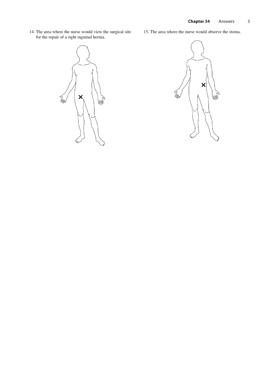 Chapter 34 Nursing Care of Patients with Lower Gastrointestinal Disorders - Page 3