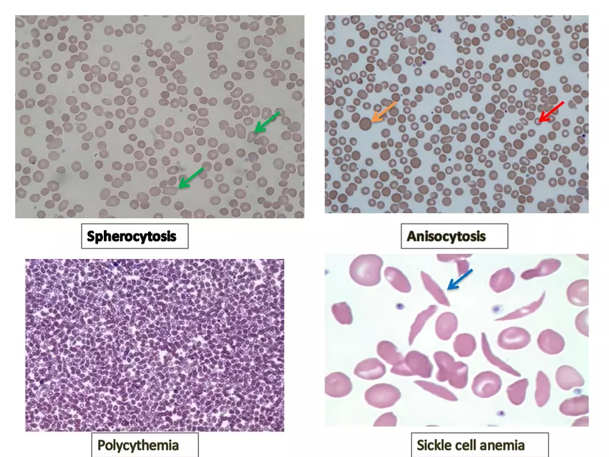 Blood Cells Notes - Page 58