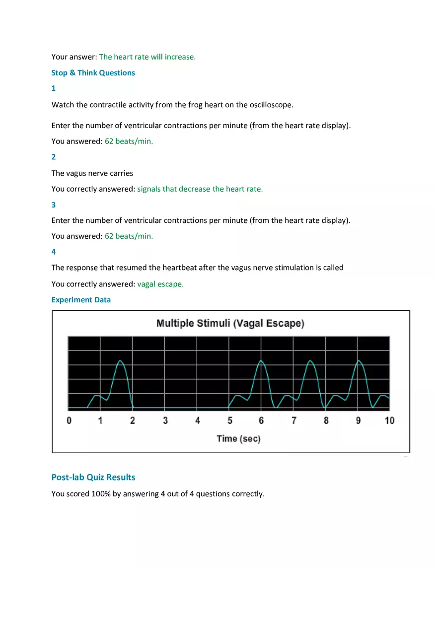 Examining the Effect of Vagus Nerve Stimulation - Page 2