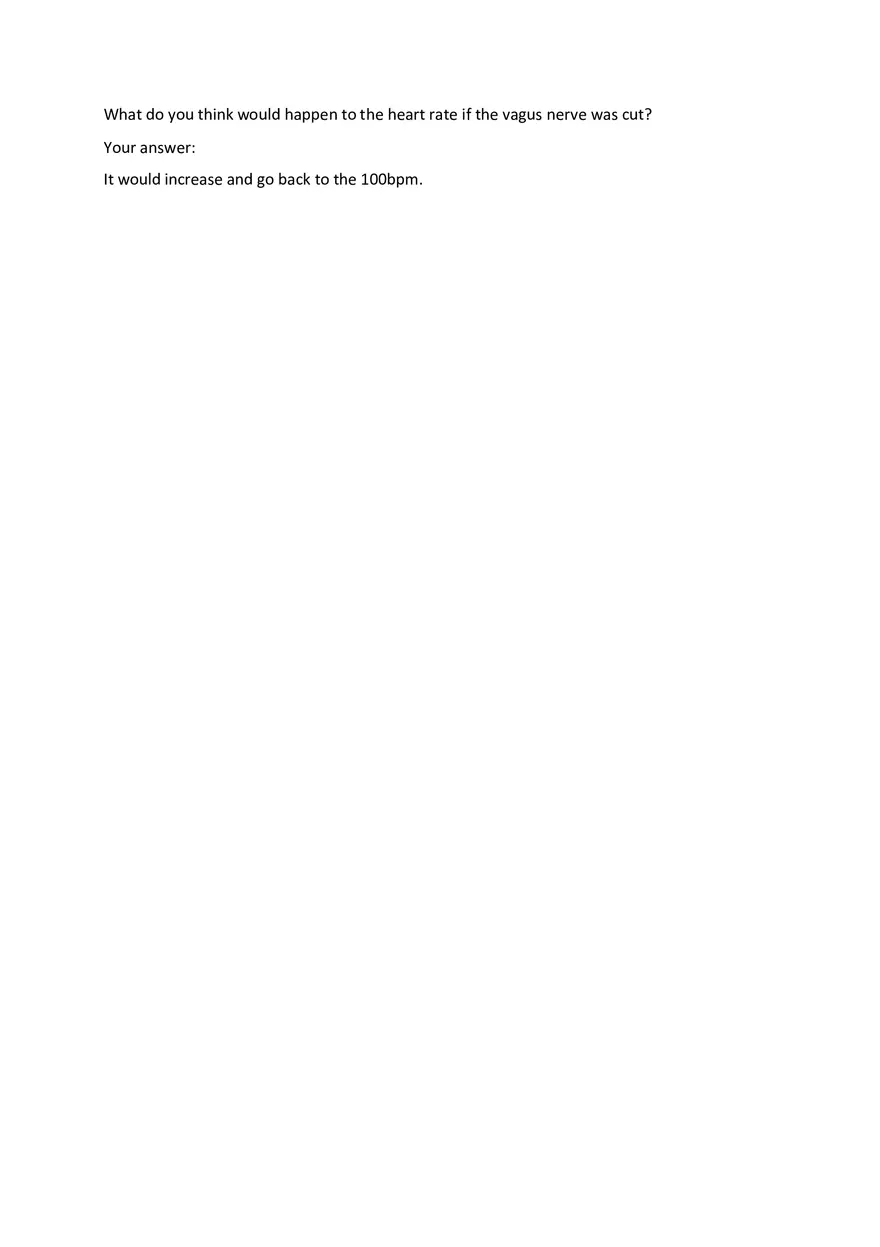 Examining the Effect of Vagus Nerve Stimulation - Page 4