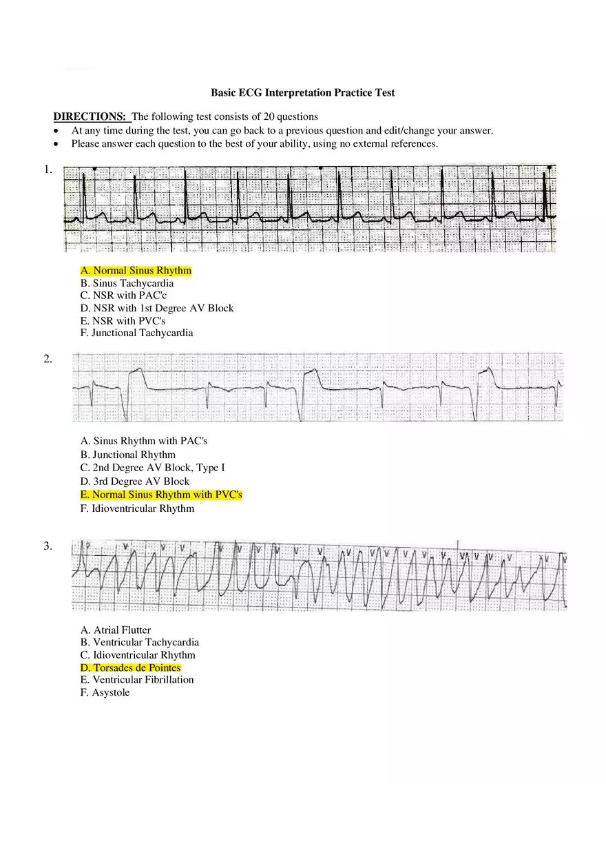 Basic ECG Interpretation Practice Test - Page 1