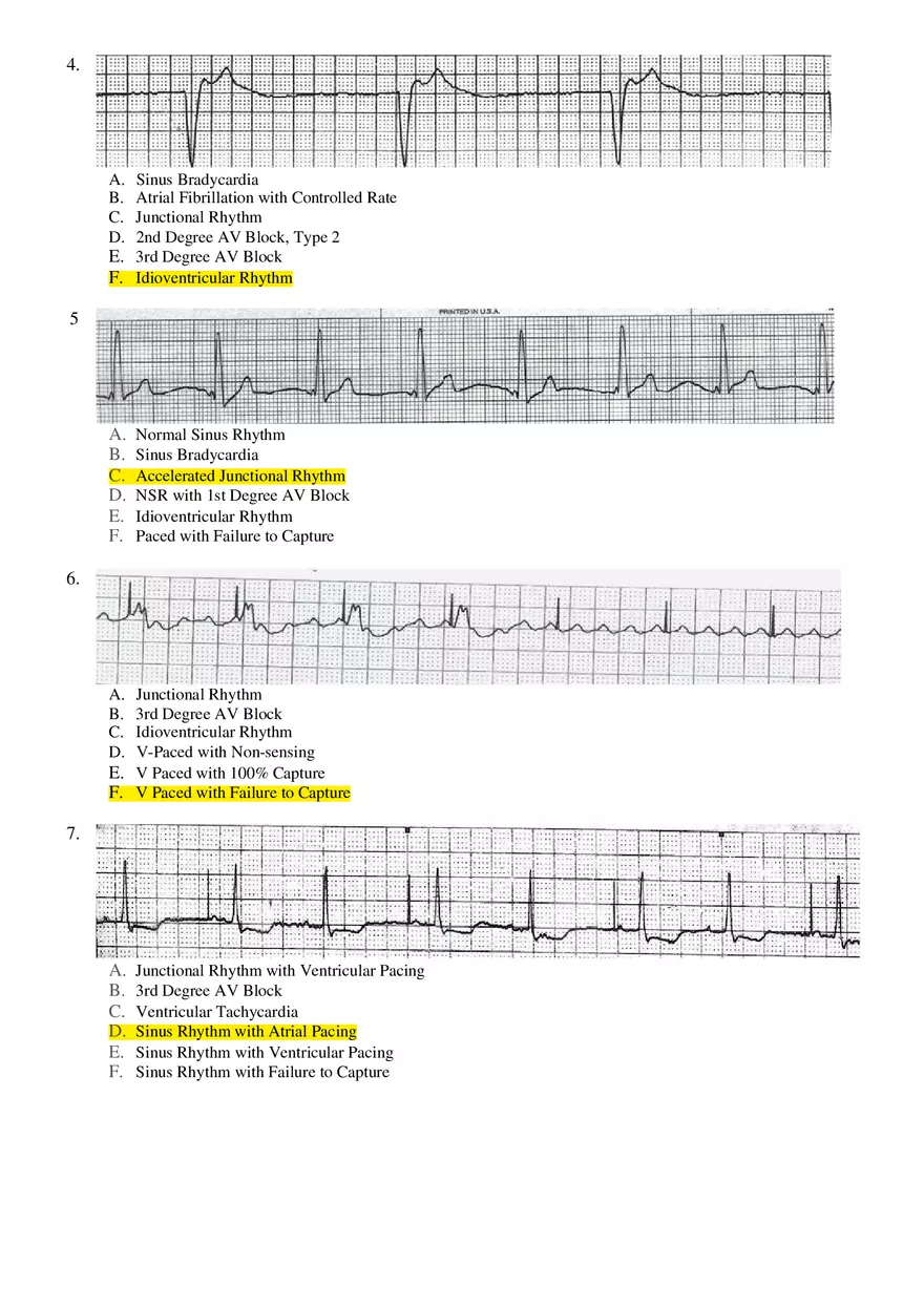 Basic ECG Interpretation Practice Test - Page 2