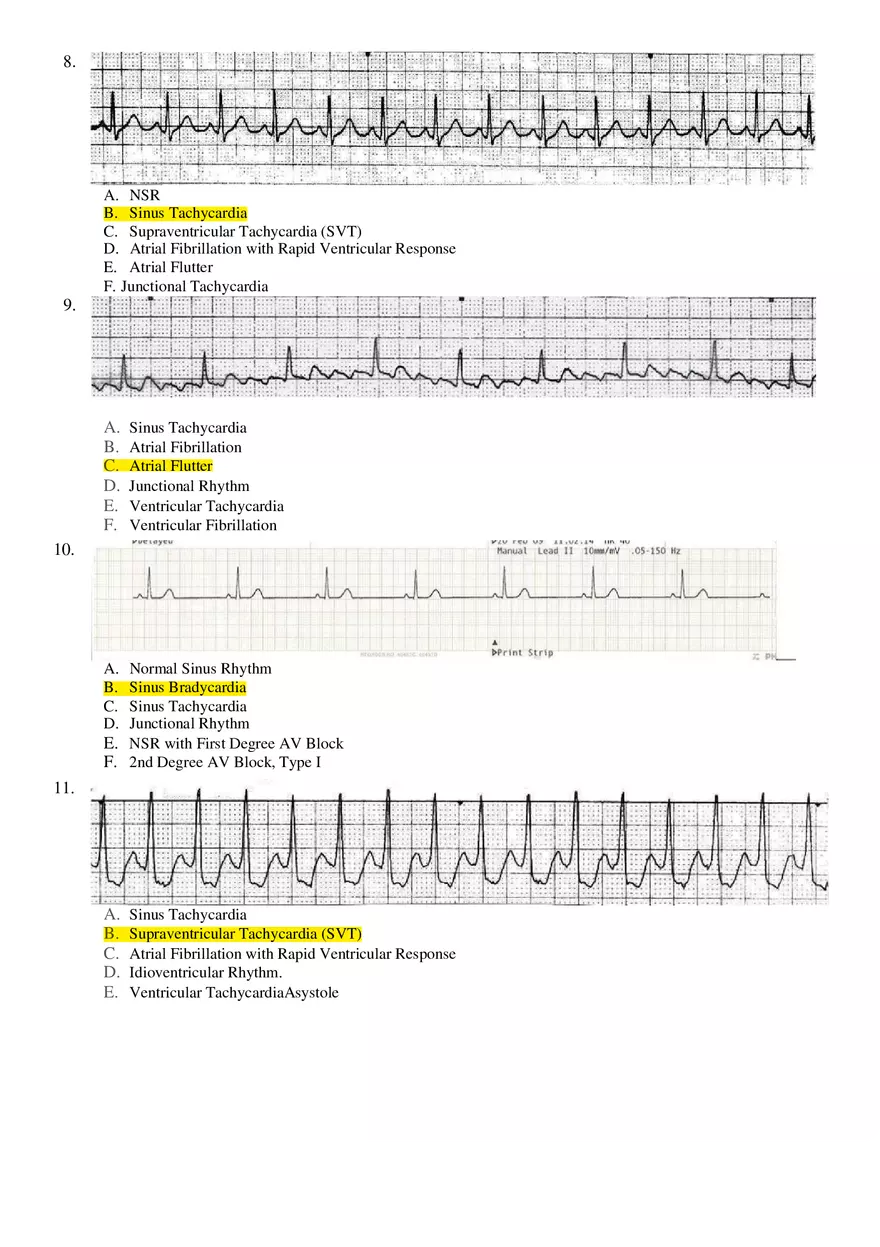 Basic ECG Interpretation Practice Test - Page 3