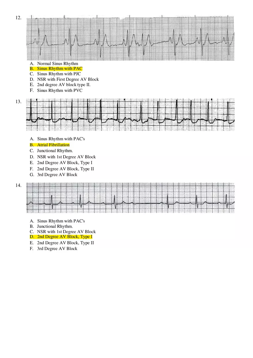 Basic ECG Interpretation Practice Test - Page 4