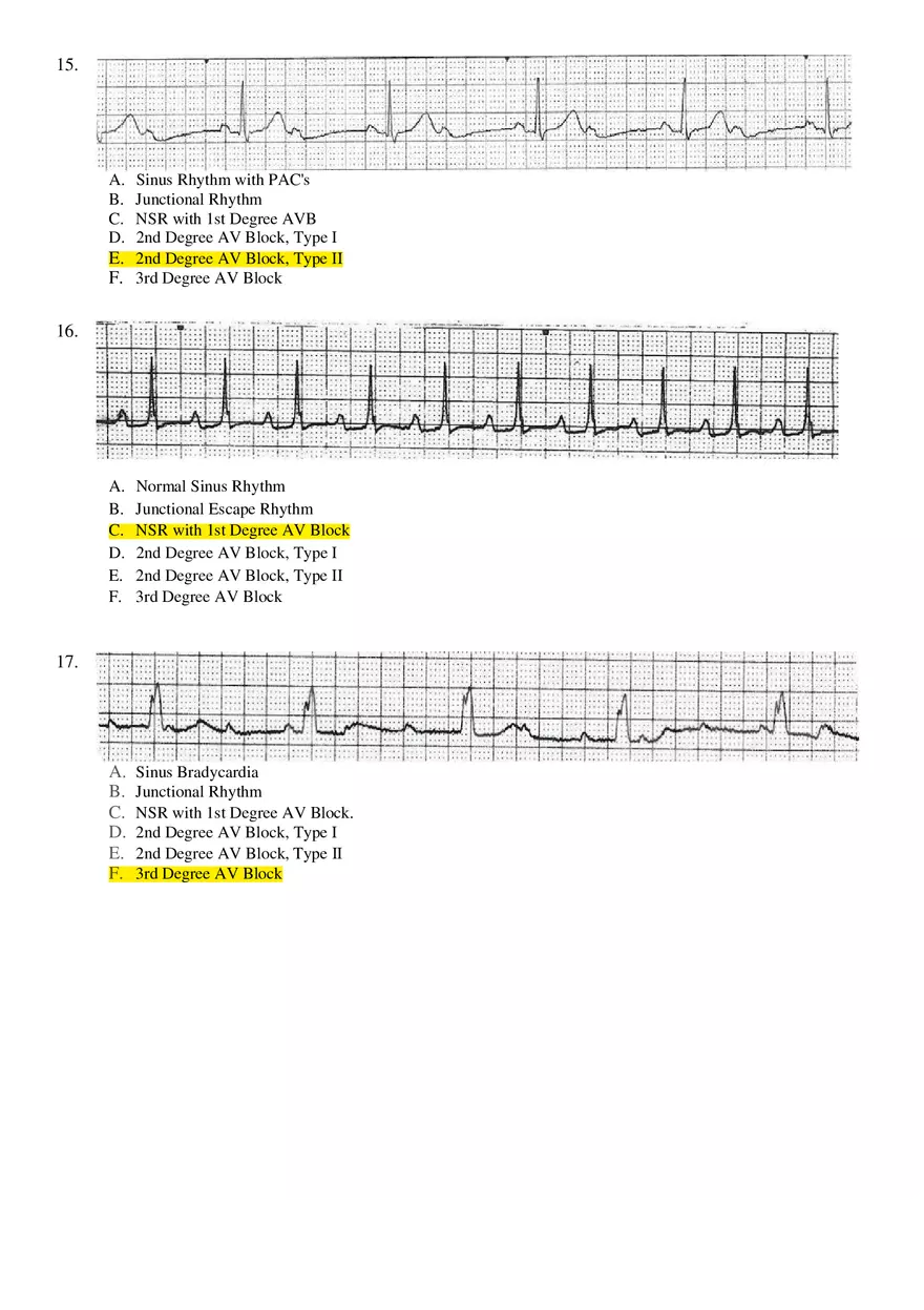 Basic ECG Interpretation Practice Test - Page 5