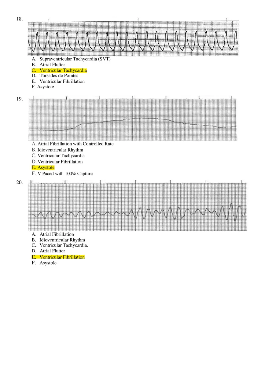 Basic ECG Interpretation Practice Test - Page 6