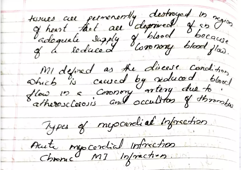 Myocardial Infraction - Page 2