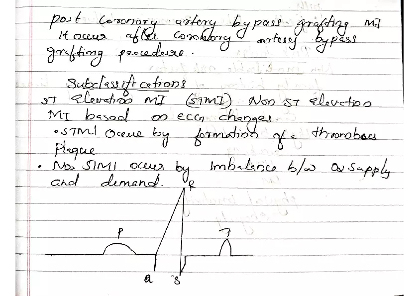 Myocardial Infraction - Page 5