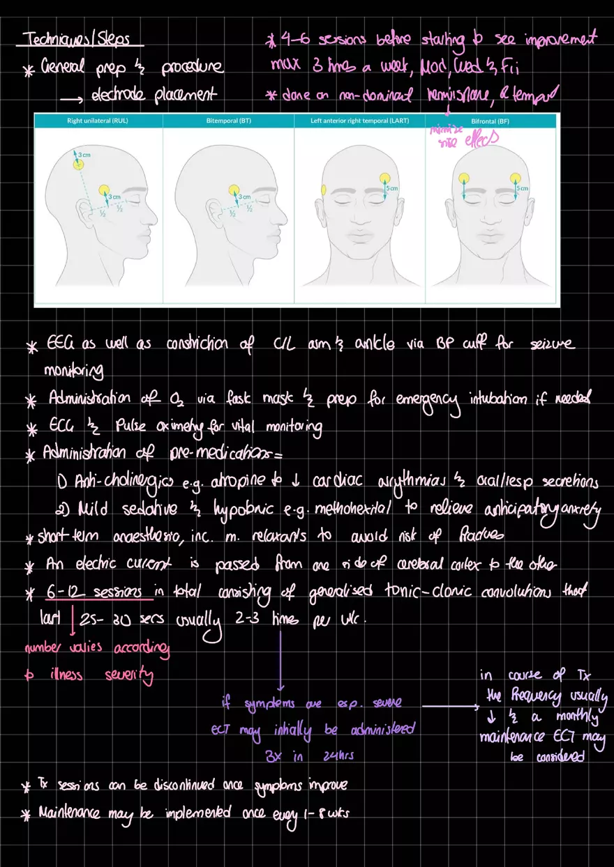 Electroconvulsive Therapy Specialized - Page 2