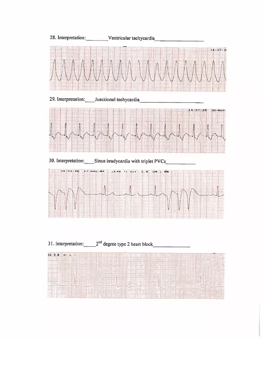 ECG Practice Exam Answers - Page 7