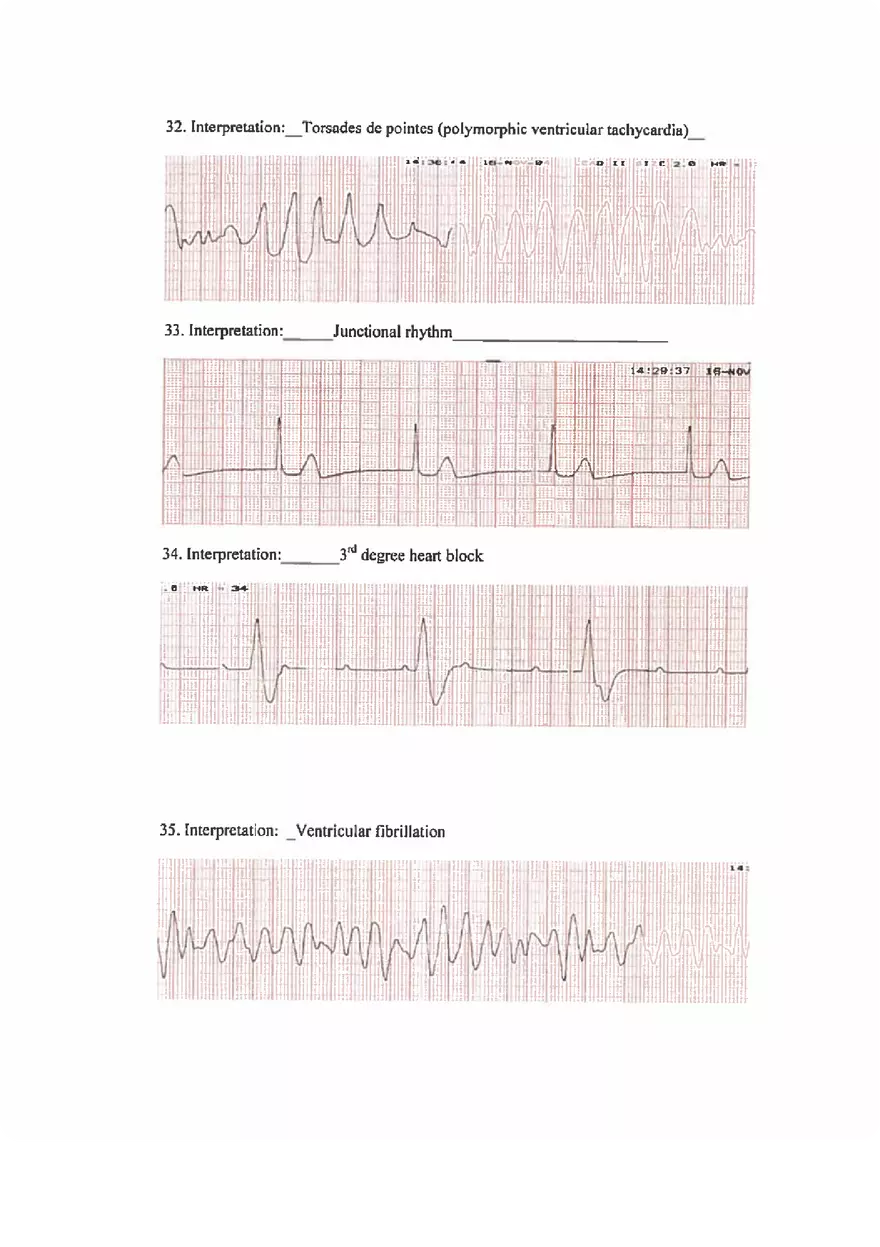 ECG Practice Exam Answers - Page 8