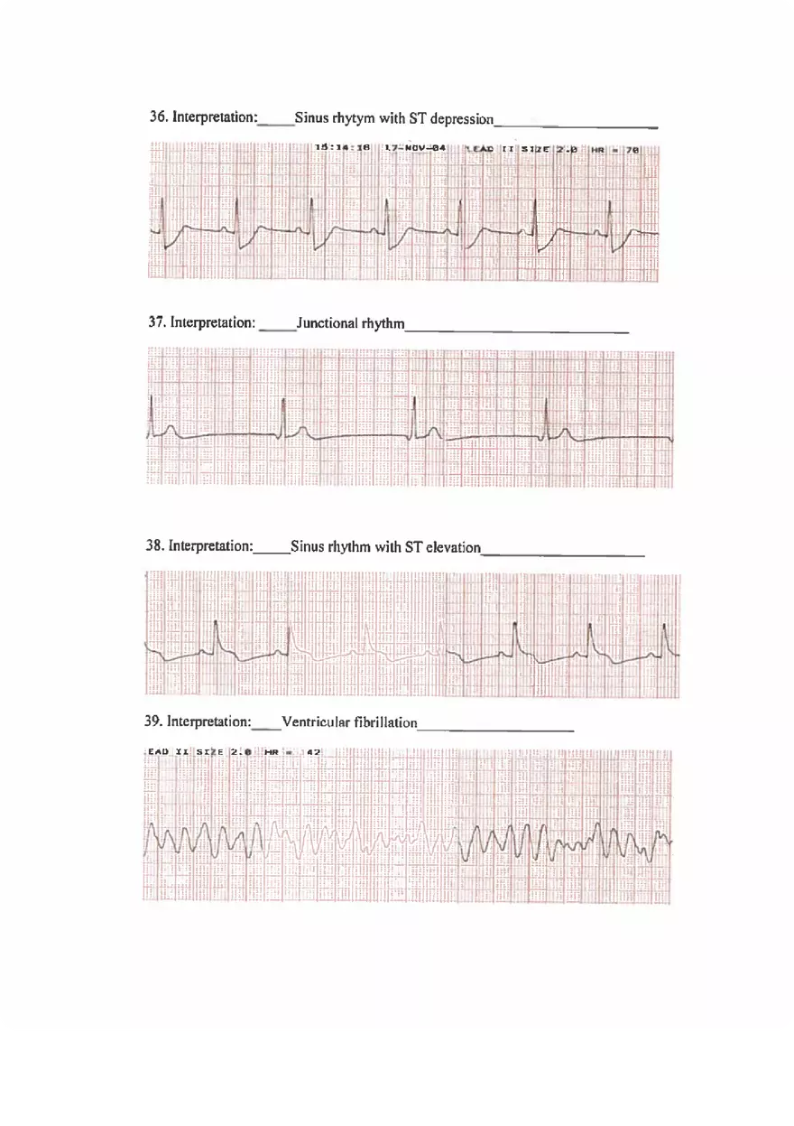 ECG Practice Exam Answers - Page 9