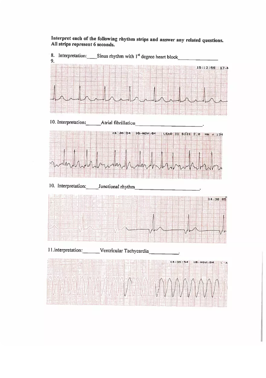 ECG Practice Exam Answers - Page 2