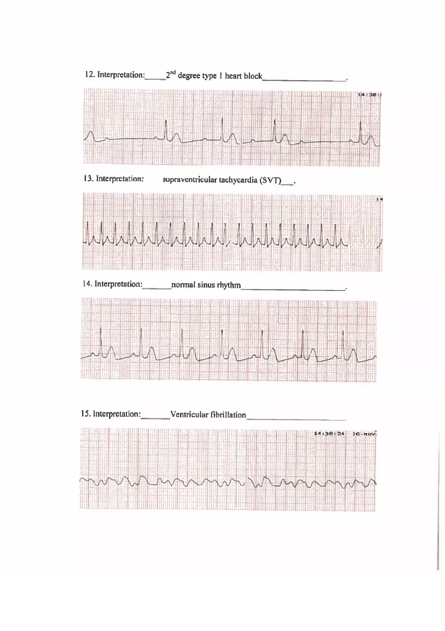 ECG Practice Exam Answers - Page 3