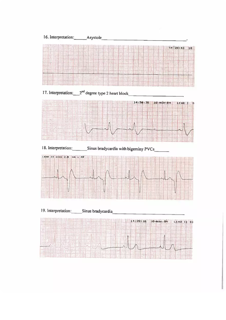 ECG Practice Exam Answers - Page 4