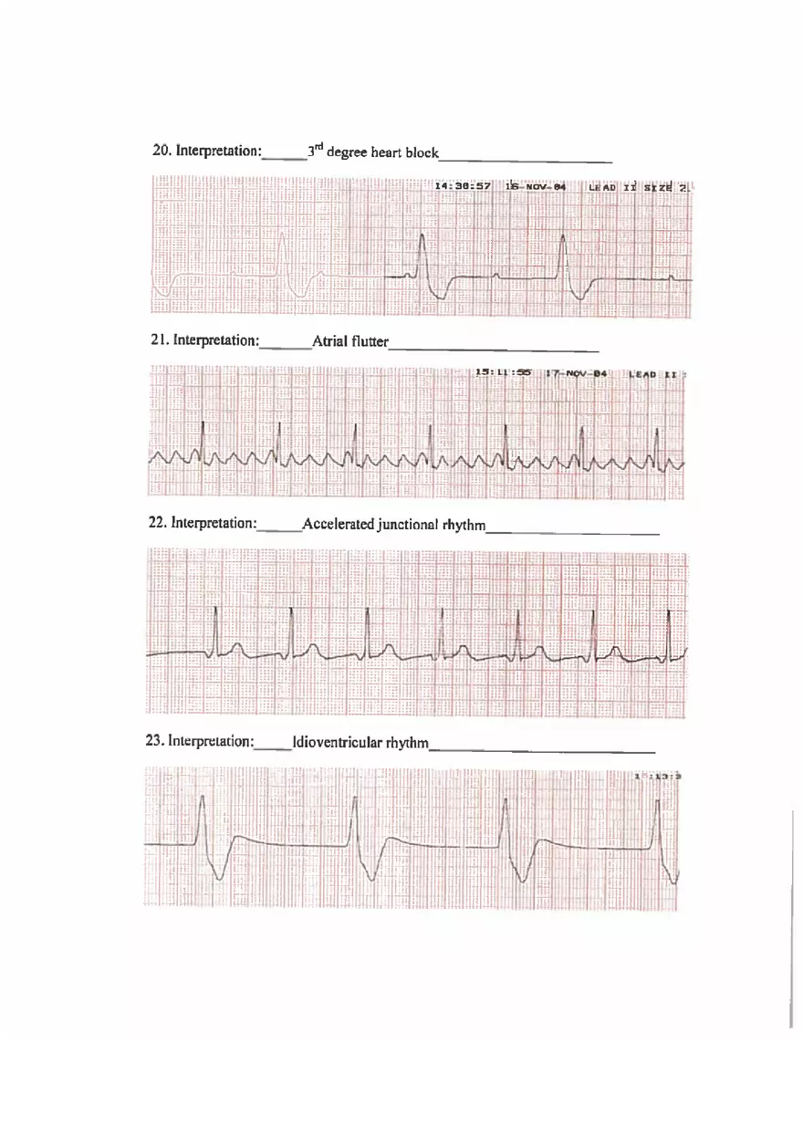 ECG Practice Exam Answers - Page 5