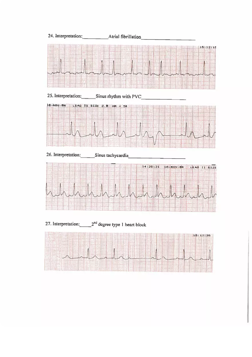 ECG Practice Exam Answers - Page 6