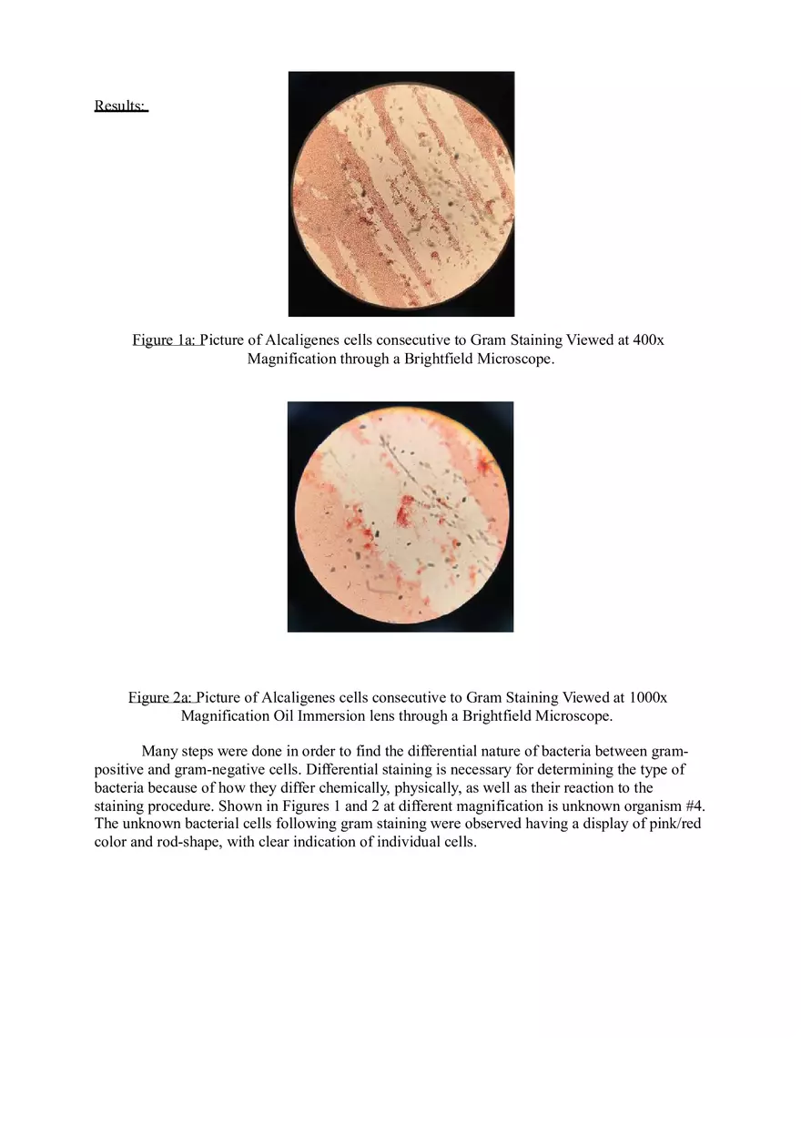 The Use of Biochemical Techniques in Identifying Unknown Bacteria #4 Report - Page 4
