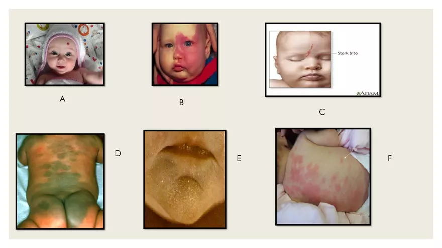 Newborn Transition to Extrauterine Life - Page 15