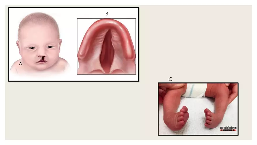 Newborn Transition to Extrauterine Life - Page 17