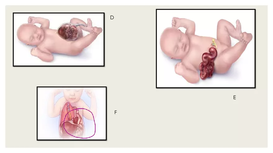 Newborn Transition to Extrauterine Life - Page 18