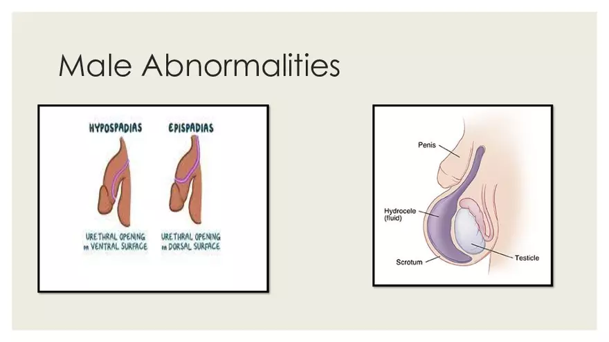 Newborn Transition to Extrauterine Life - Page 20