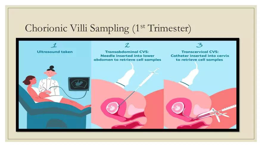 Fetal Development, Screenings, and Diagnostics - Page 8