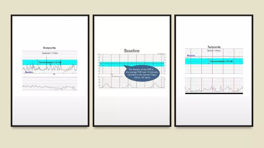 Fetal Development, Screenings, and Diagnostics - Page 22