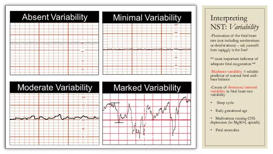 Fetal Development, Screenings, and Diagnostics - Page 23