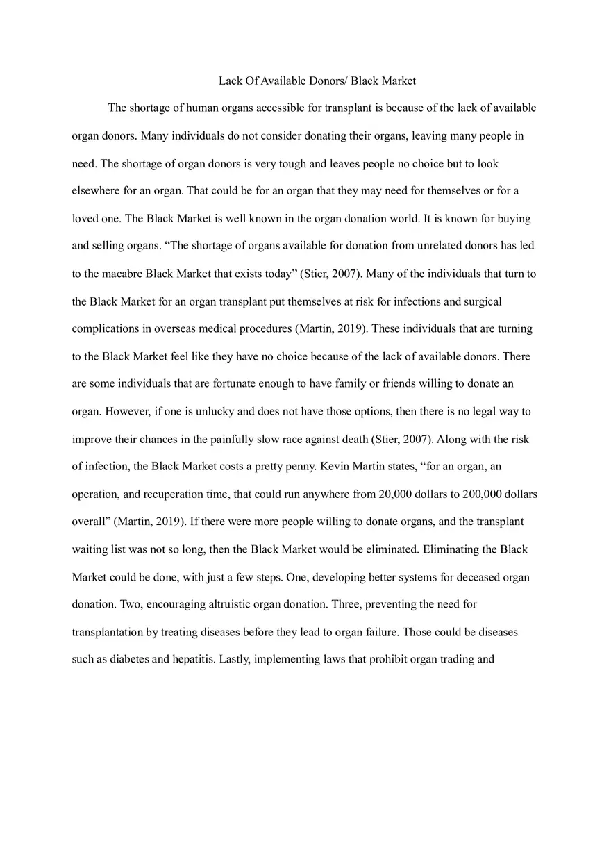 Solving Organ Shortages Proposal Essay - Page 3