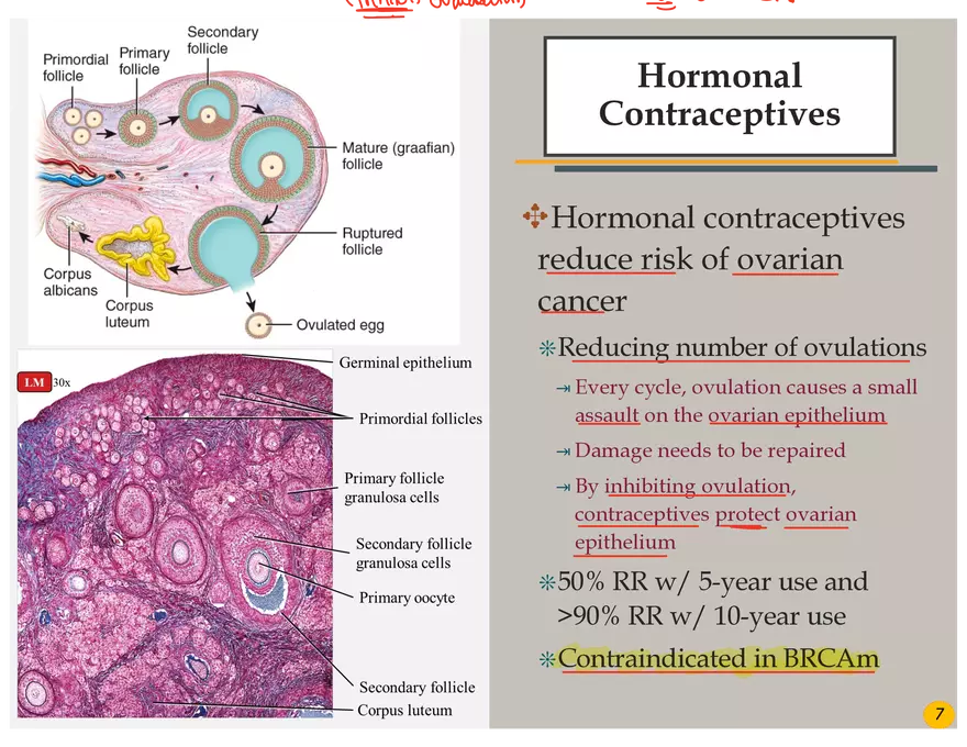 Ovarian Cancer Presentation - Page 9