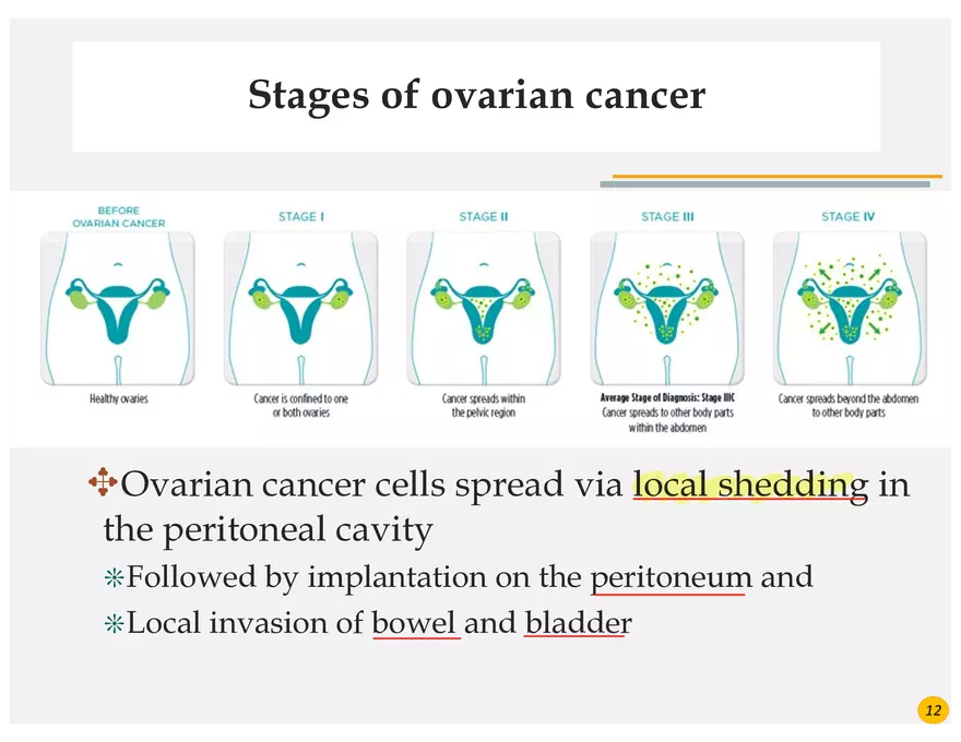 Ovarian Cancer Presentation - Page 14