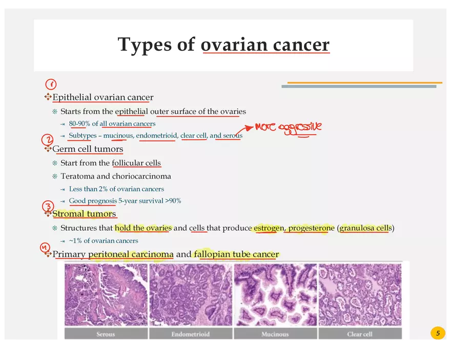 Ovarian Cancer Presentation - Page 2