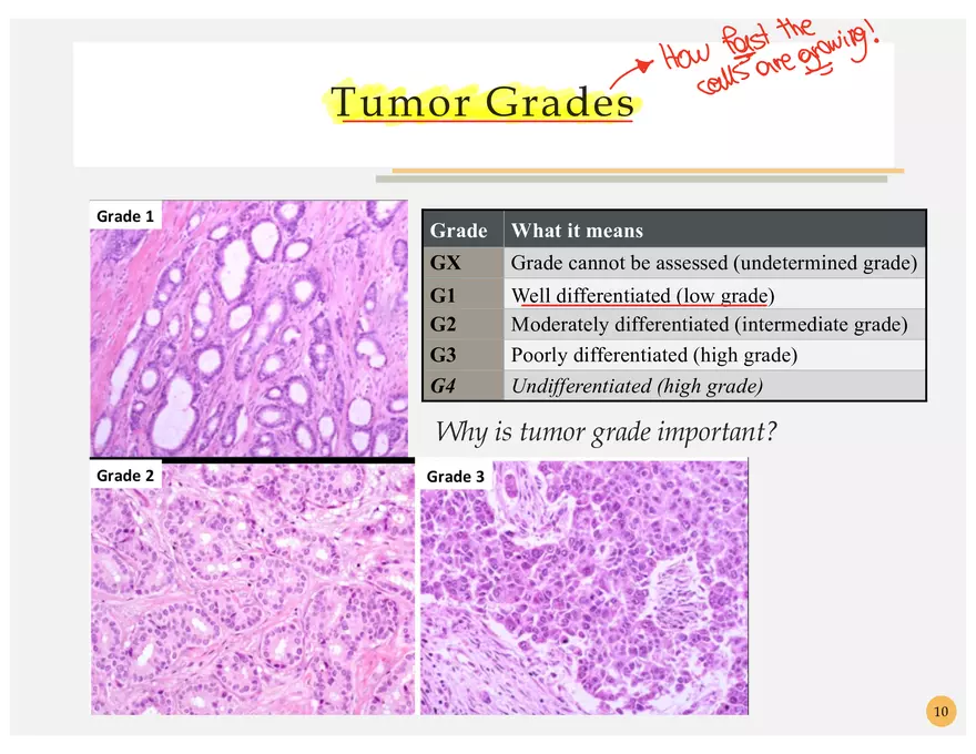 Oncology Terminology - Page 19