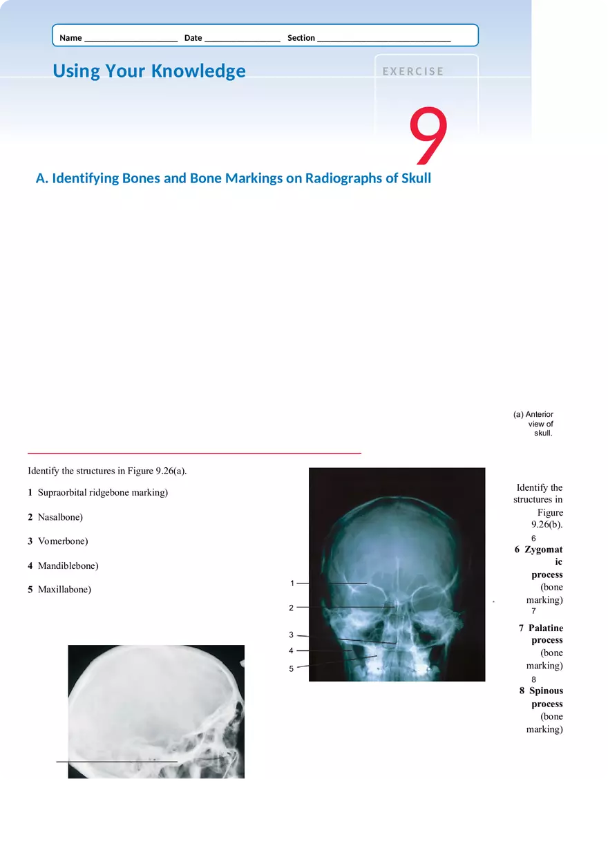Identifying Bones and Bone Markings on Radiographs of Skull - Page 1