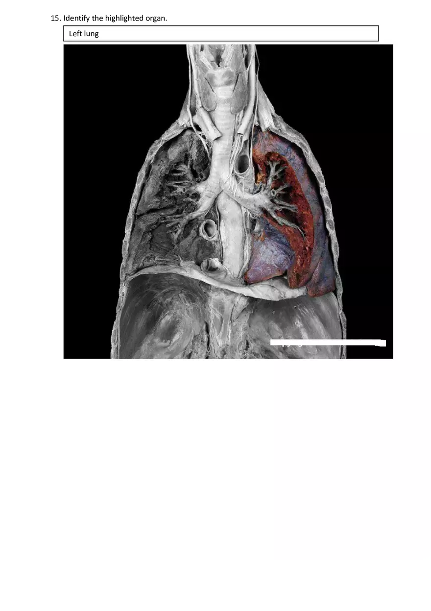 Real Anatomy Worksheet Answer Key Respiratory System - Page 7